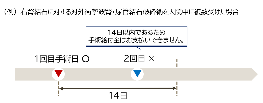 一連の手術1013.PNG